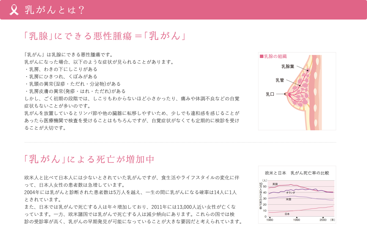 乳がんとは？ 「乳腺」にできる悪性腫瘍＝「乳がん」